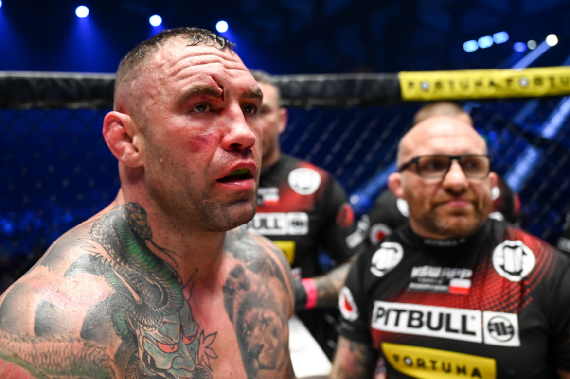 Paczuski: Potworne rozcięcie na twarzy gwiazdy KSW