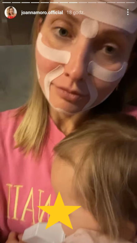 Co Joanna Moro zrobiła z twarzą?