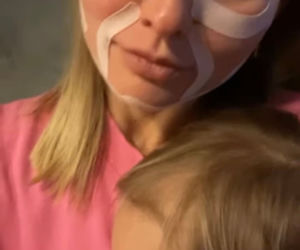 Co Joanna Moro zrobiła z twarzą?