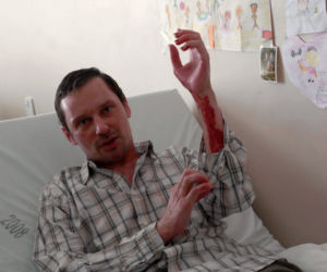 Poparzony Krzysztof Ziemiec