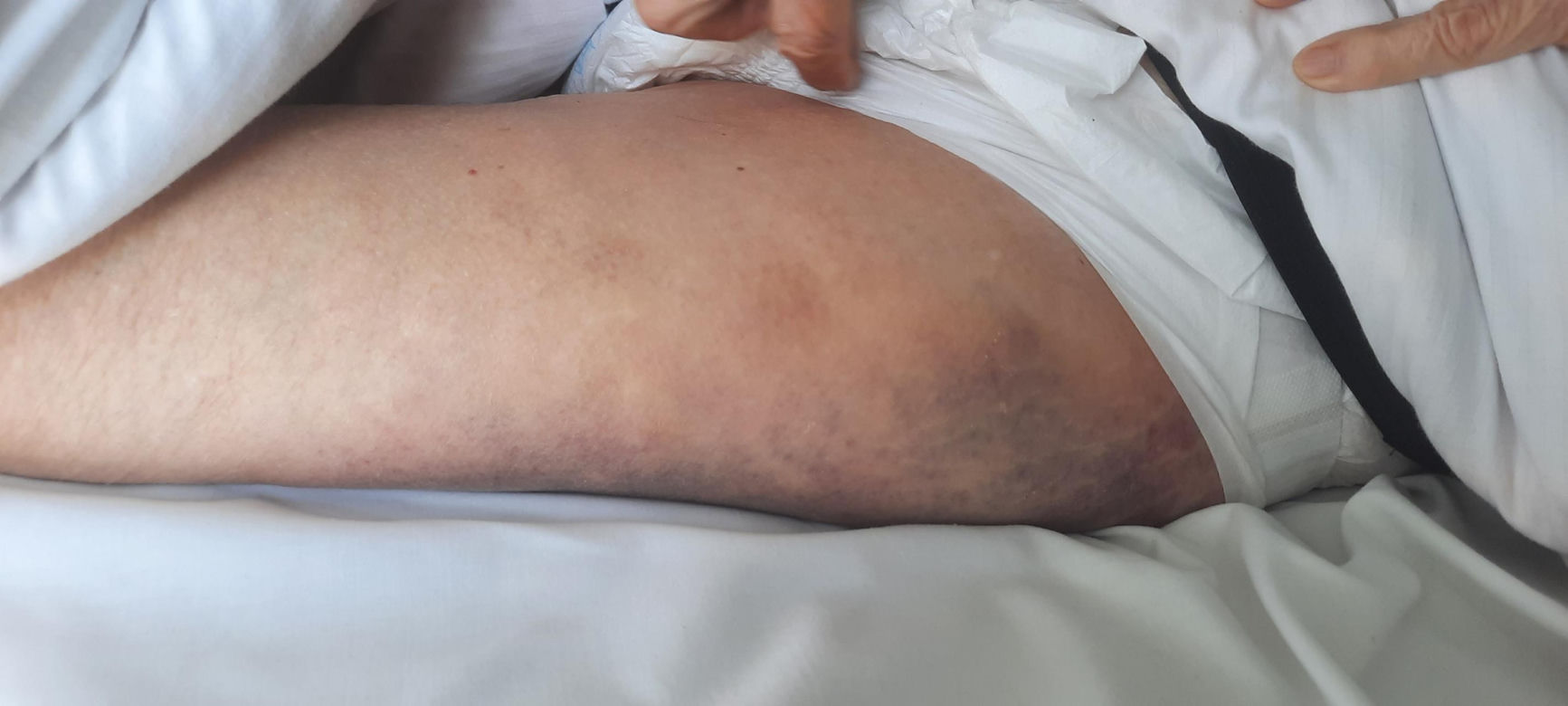 92-letnia Maria z Warszawy ofiarą bestialskiego ataku. „Zrujnował kobiecie starość za 300 zł”