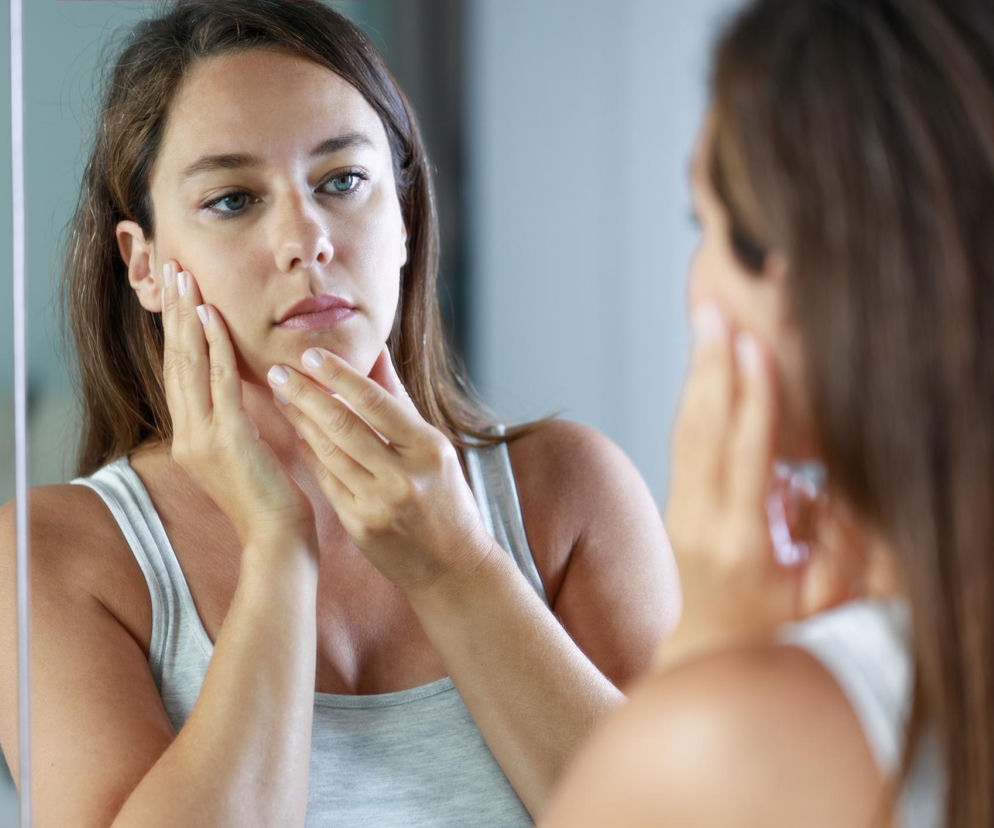 Masz takie zmiany? To może być „twarz stresowa”. Oto, jak kortyzol niszczy twoją cerę