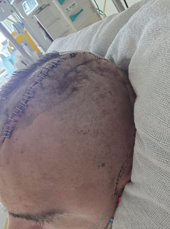 Karol pojechał zarobić na dom dla córek. Sam w nim nie zamieszka. Leży sparaliżowany po bestialskim ataku w Belgii