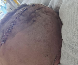 Karol pojechał zarobić na dom dla córek. Sam w nim nie zamieszka. Leży sparaliżowany po bestialskim ataku w Belgii