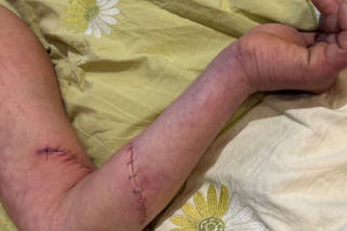 Stanął w obronie kobiety, skatowali go maczetami. Piotrek ledwo przeżył. Niemal mnie zabili