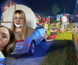 Majówka zmienił się w horror. Poparzona inluencerka do tej pory walczy o sprawiedliwość