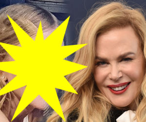  Nicole Kidman ma nową twarz! Nie uwierzysz, gdy ją zobaczysz