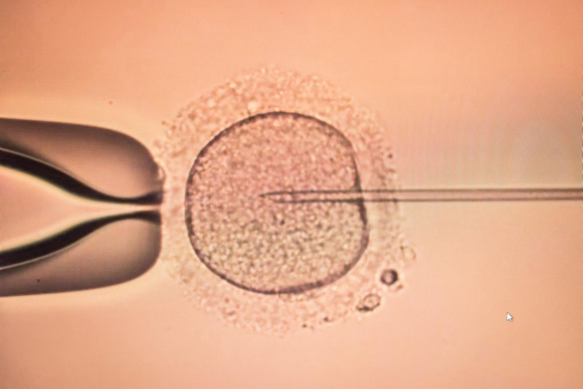 Rządowy program in vitro. W tych miastach wykonasz zabieg za darmo.