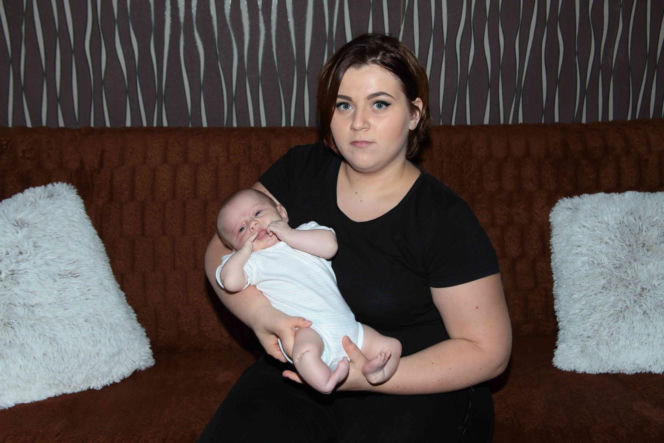 Podarujmy Amelce protezy pod choinkę