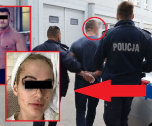 Gdańsk: Znany trener osobisty pobił swoją dziewczynę! [DRASTYCZNE ZDJĘCIA]