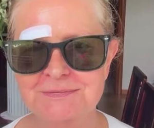 Barbara Busztynowicz miała wypadek! Skończyło się szyciem. Nikt się nie zatrzymał
