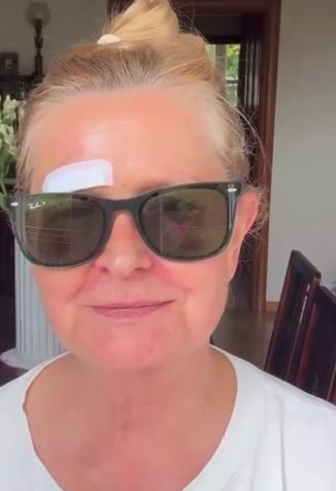 Barbara Busztynowicz miała wypadek! Skończyło się szyciem. "Nikt się nie zatrzymał"