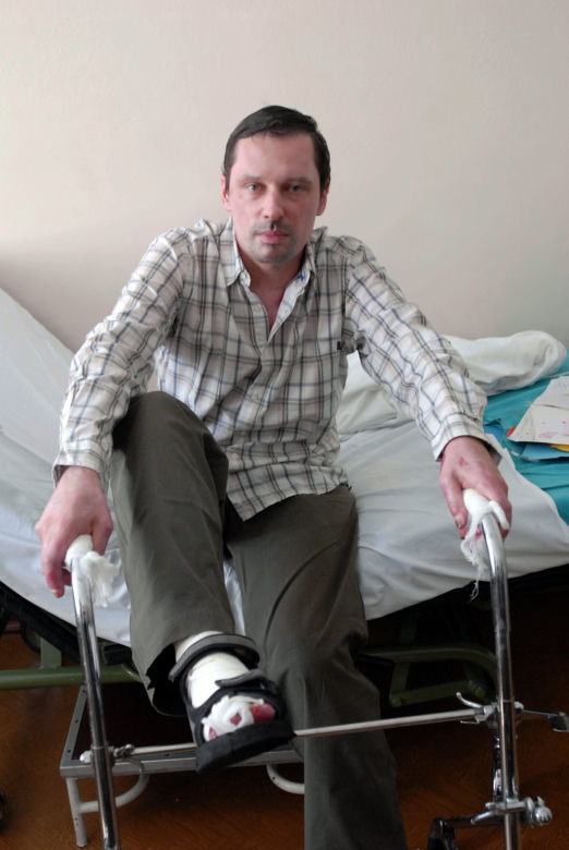 Poparzony Krzysztof Ziemiec