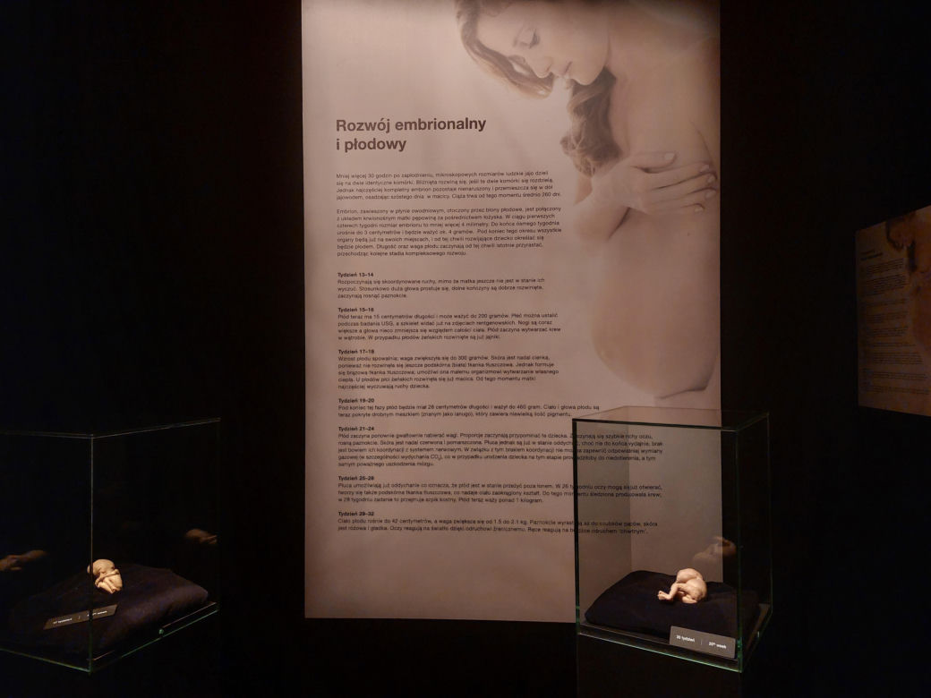 Wystawa Body Worlds w Szybie Wilson w Katowicach
