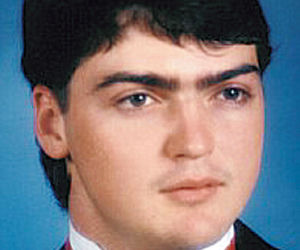 Przeszczep twarzy
