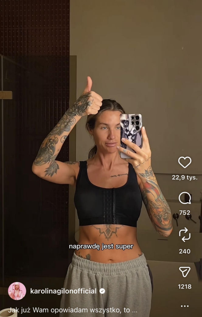 Karolina Gilon zoperowała biust. Zdjęcia przed i po