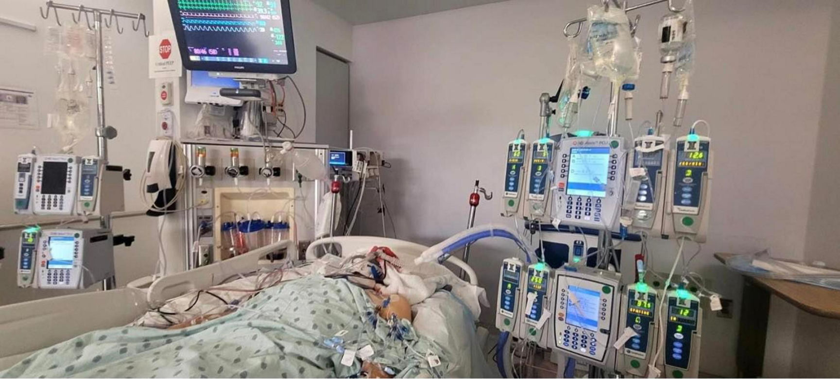 Polak walczy o życie po zderzeniu z koniem