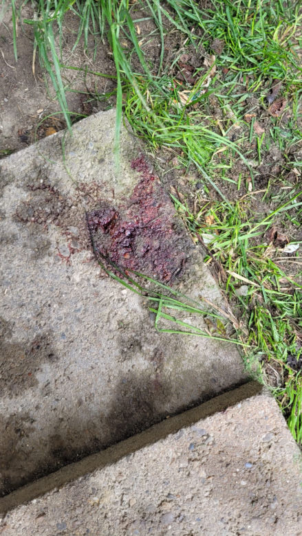 Sosnowiec: Tragiczna śmierć 13-letniego chłopca. Zginął w tajemniczych okolicznościach 