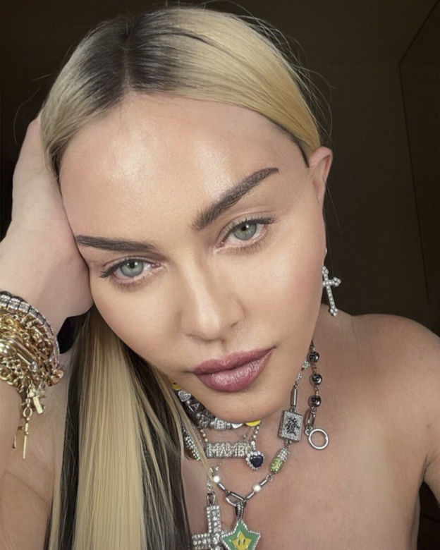  Madonna ma nową twarz! 64-latka przeszła kolejne operacje?