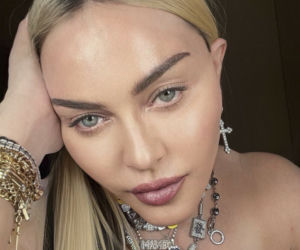  Madonna ma nową twarz! 64-latka przeszła kolejne operacje?