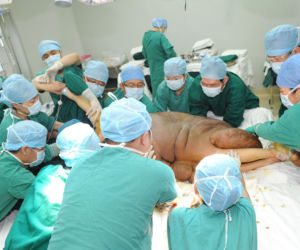 Mężczyzna z gigantycznym guzem! Narośl ważyła 107 kilogramów!