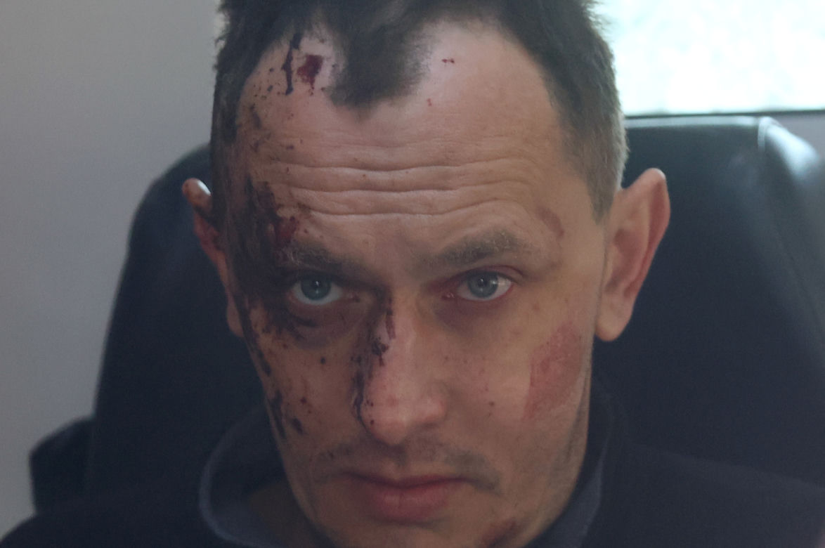35 osób zginęło w rosyjskim ostrzale rakietowym Międzynarodowego Centrum Operacji Pokojowych i Bezpieczeństwa w obwodzie lwowskim
