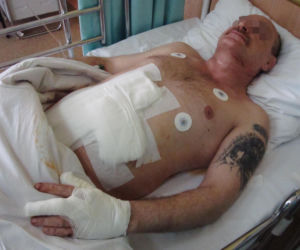 Dźgnął sąsiada bo cuchnęły mu jego ziółka