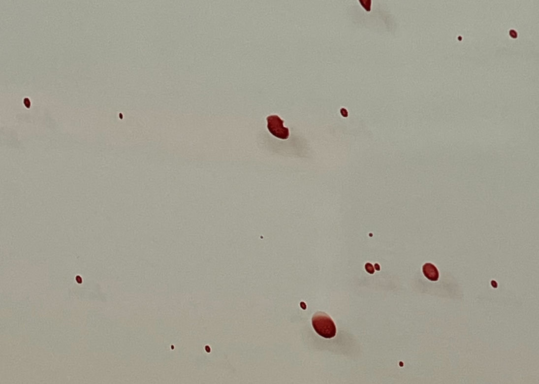 Masakra na Ochocie. Kobieta dźgnięta w twarz. Kłótnia sąsiedzka zakończona krwawymi porachunkami