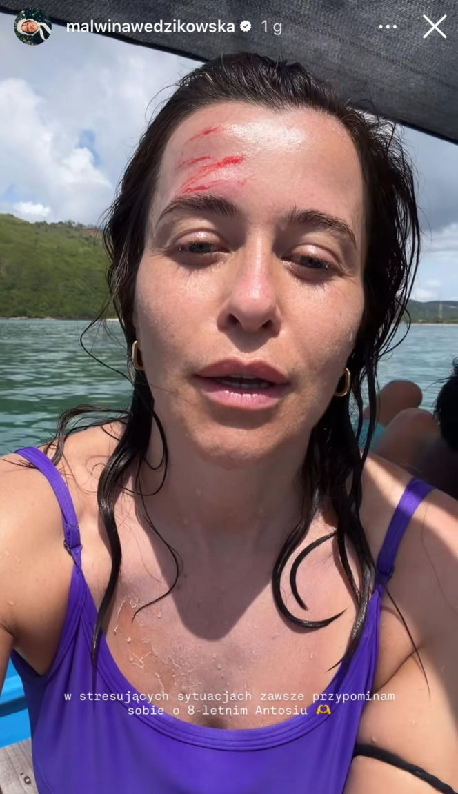 Malwina Wędzikowska miała groźny wypadek