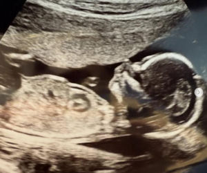 Aleksandra Gałczyńska