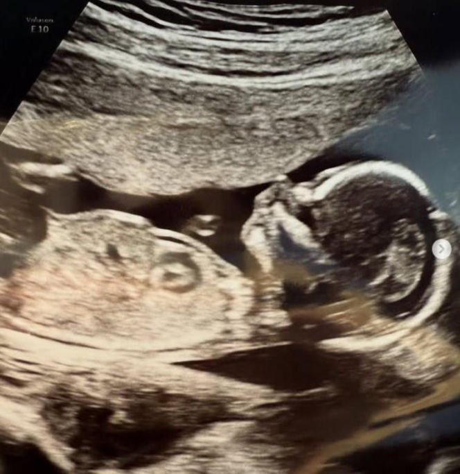 Aleksandra Gałczyńska