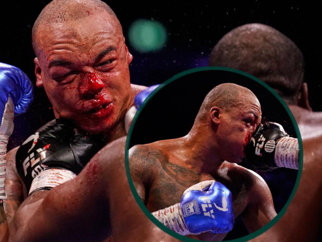 Krwawa walka Daniel Dubois - Fabio Wardley