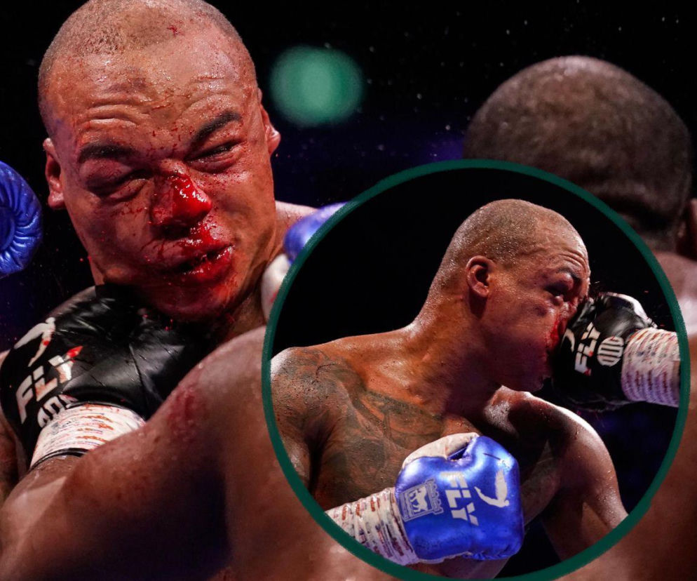 Krwawa walka Daniel Dubois - Fabio Wardley