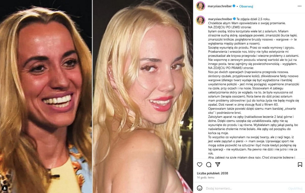 Marianna Schreiber pokazała, co konkretnie poprawiła w twarzy: "Przypiłowane kości"