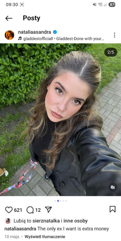 Natalia Zambrzycka (Agata z serialu Barwy szczęścia) powiększa sobie usta od lat