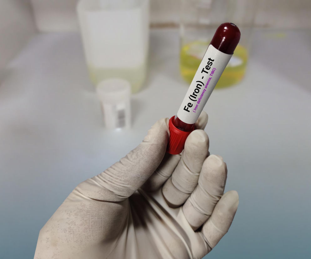 Dłoń w białej rękawiczce laboratoryjnej trzyma probówkę z krwią, oznaczoną jako Fe (Iron) - Test (Iron deficiency anemia, TIBC), na tle rozmytego laboratorium. Zdjęcie ilustruje znaczenie badań krwi w diagnostyce niedoboru żelaza, o czym więcej przeczytasz na Poradnik Zdrowie.