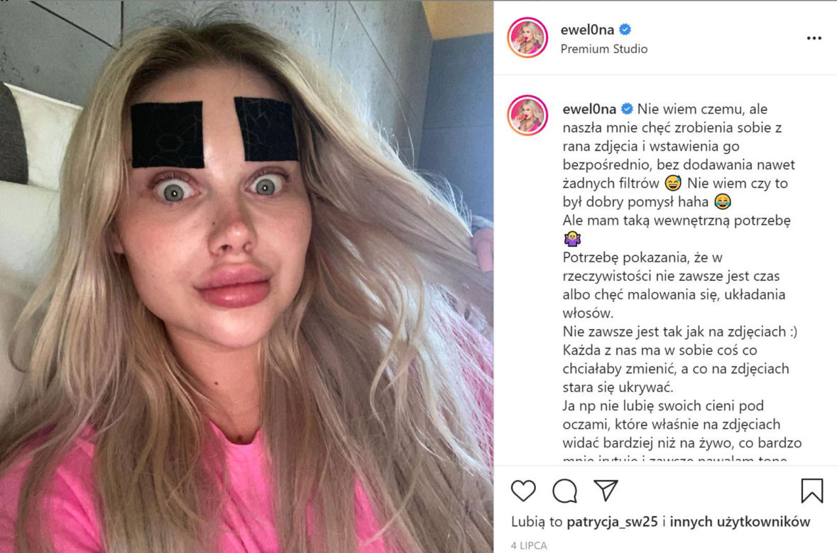 Ewelina z Warsaw Shore przesadziła z operacjami
