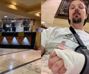 Michał Figurski trafił do szpitala. Szokujące ZDJĘCIA w sieci