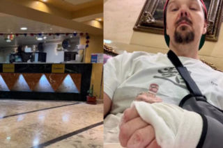 Michał Figurski trafił do szpitala. Szokujące ZDJĘCIA w sieci