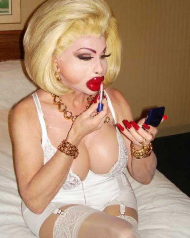 Amanda Lepore, ofiary operacji plastycznych