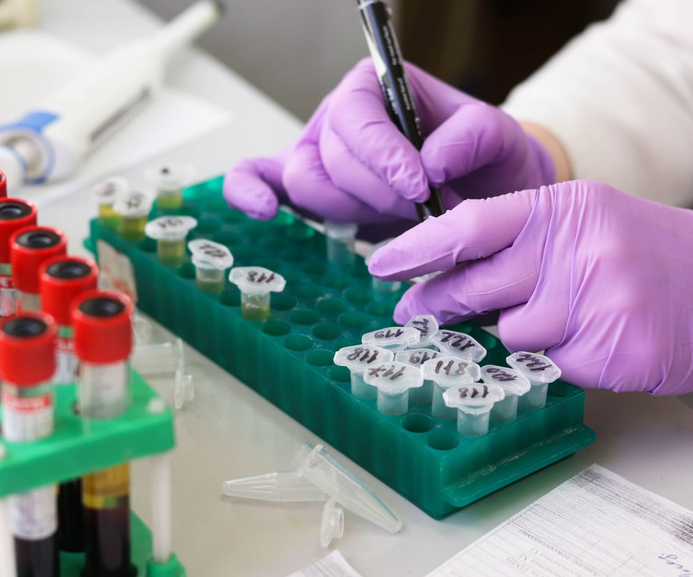 Lab test