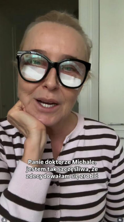 Agata Młynarska wycięła sobie powieki