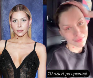 Julia von Stein nie zamierza odpuścić lekarzowi! Sprawa trafia do prawników