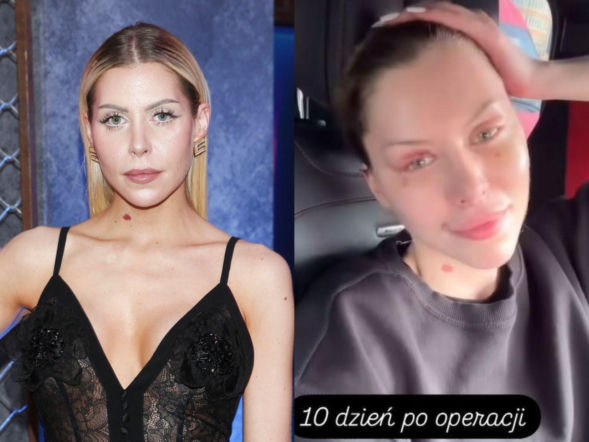 Julia von Stein nie zamierza odpuścić lekarzowi! Sprawa trafia do prawników