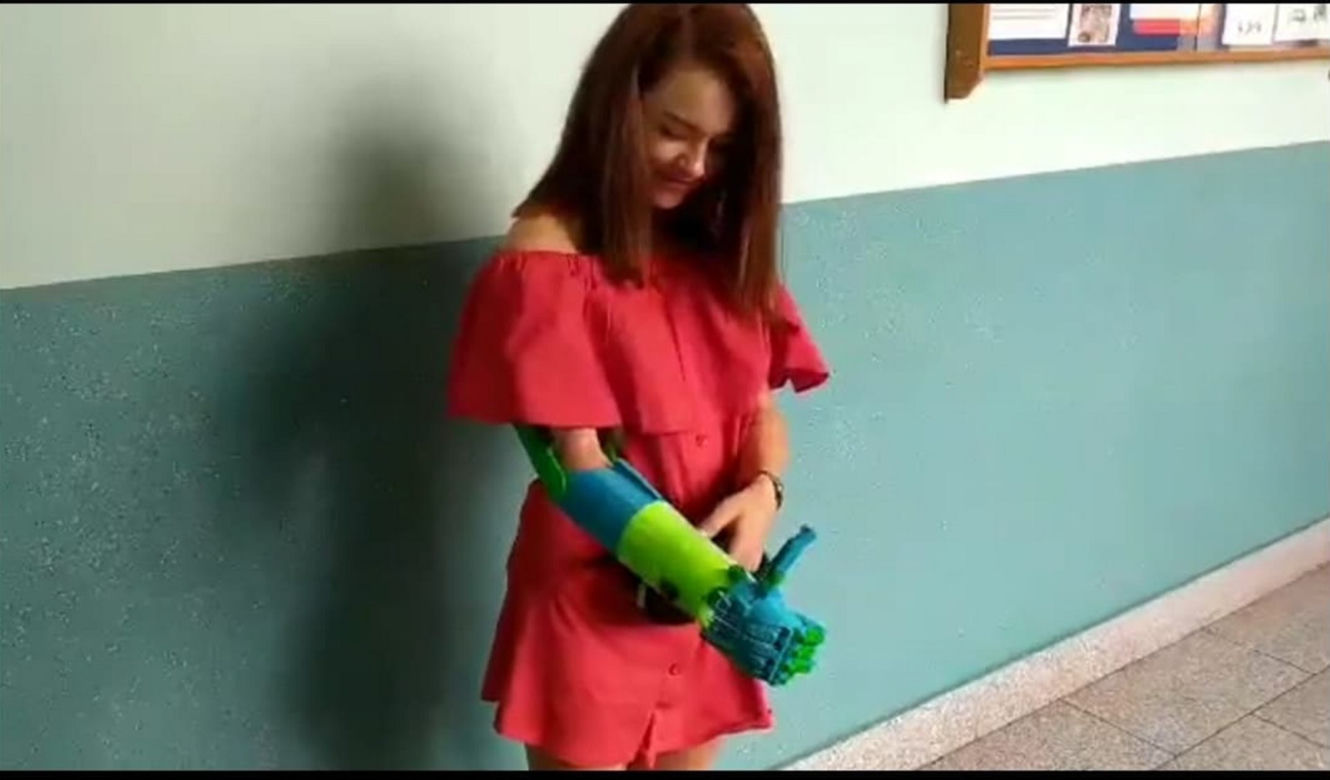 Koledzy wydrukowali Kindze kolejną rękę w 3D