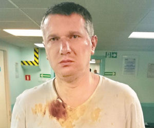 Pijany poseł pobił się z policjantami