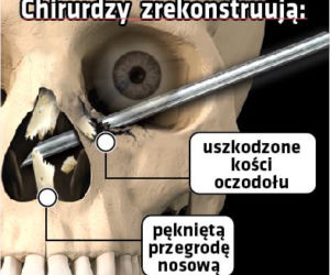 Dziękuję lekarzom że uratowali mi wzrok
