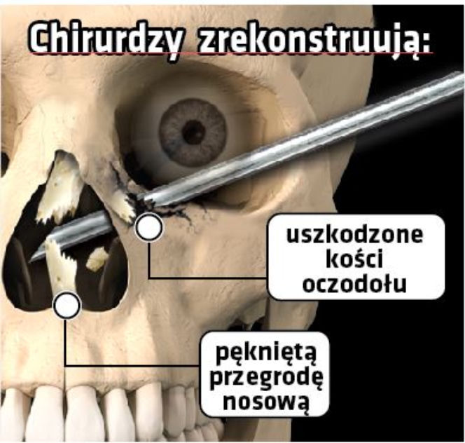 Dziękuję lekarzom że uratowali mi wzrok