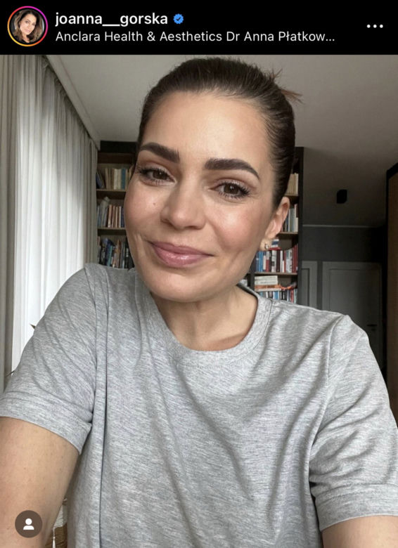 Joanna Górska wycięła sobie powieki. Drastyczne zdjęcia 