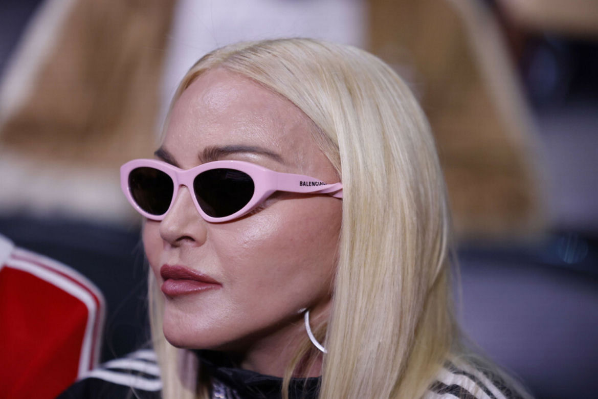  Madonna ma nową twarz! 64-latka przeszła kolejne operacje?